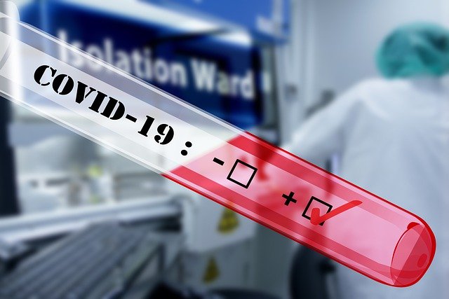 1014 nowych zakażeń SARS-CoV-2 w Wielkopolsce. Minionej doby zmarło 65 osób 