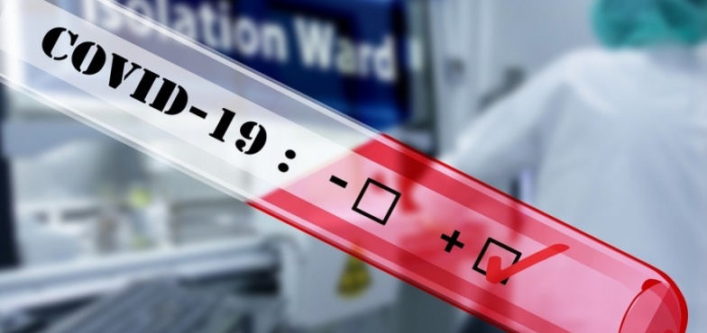 535 nowych zakażeń SARS-CoV-2 w Wielkopolsce. Zmarło 15 osób