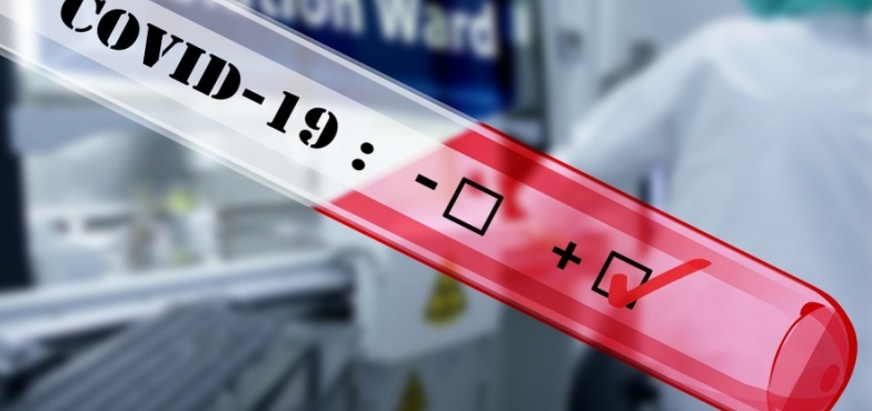 25 nowych przypadków zakażenia koronawirusem w powiecie tureckim